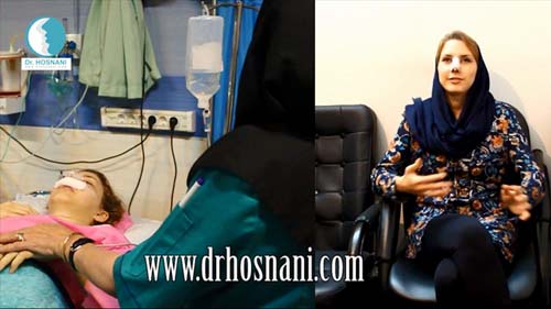 هزینه عمل بینی توسط دکتر حسنانی