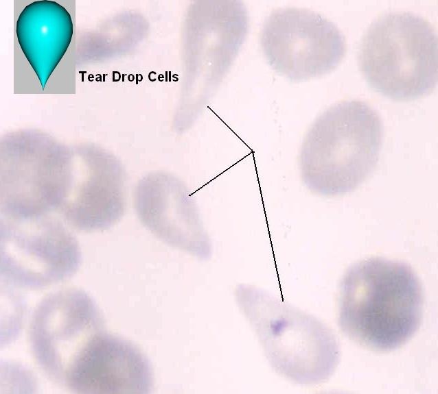 اطلس مرفولوژی گویچه های قرمز خون RBC Morphology