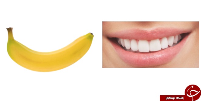 موز