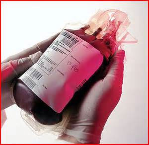 اهدا خون باعث باطل شدن روزه می شود؟