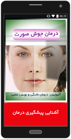 انواع جوش صورت و راه های درمان آ«
