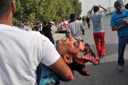 عکس ترسناک جنایات سعودی