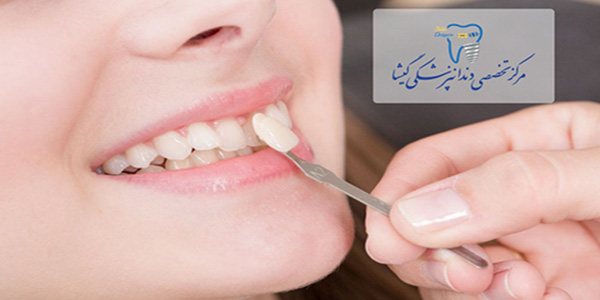 درمانهای اپن بایت یا به نرسیدن دندانهای جلویی در بزرگسالان