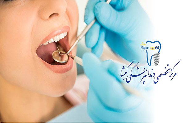 چگونه بهترین دندانپزشک تهران را پیدا کنیم؟
