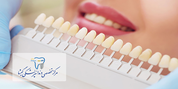 توضیحات متخصص زیبایی دندان در تهران