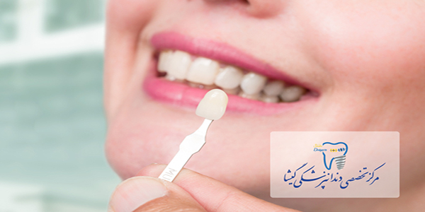 انواع روکش های تمام سرامیک توسط متخصص پروتزهای دندانی و ایمپلنت در تهران