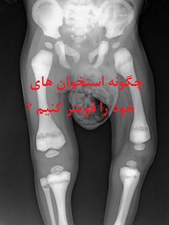 تراکم_استخوانی.jpg (331×442)