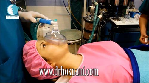 دکتر حسنانی - بیهوشی جراحی بینی