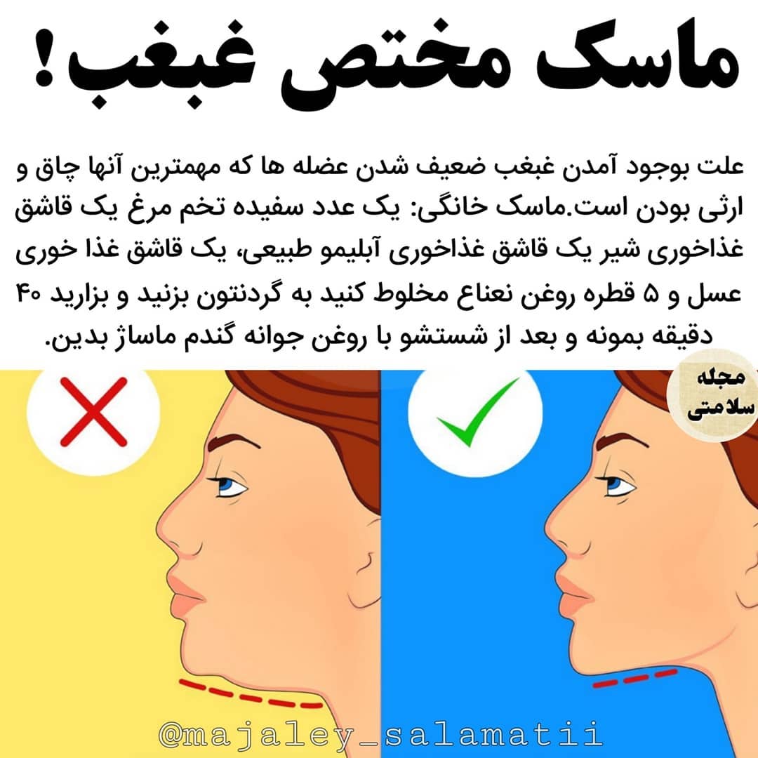 اگر بعد از ساکشن غبغب ماساژ ندیم چی میشه+آیا ساکشن غبغب درد دارد+آیا ساکشن غبغب نیاز به بیهوشی دارد+آیا غبغب با ورزش از بین می‌رود